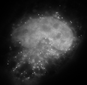 Processed Microscopy Image - Before